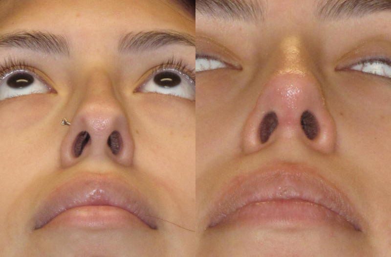 Patient 63 Combined Image