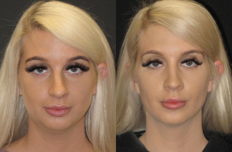 Patient 59 Combined Image