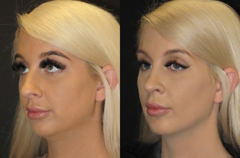 Patient 59 Combined Image