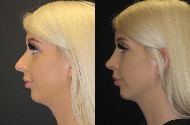 Patient 59 Combined Image