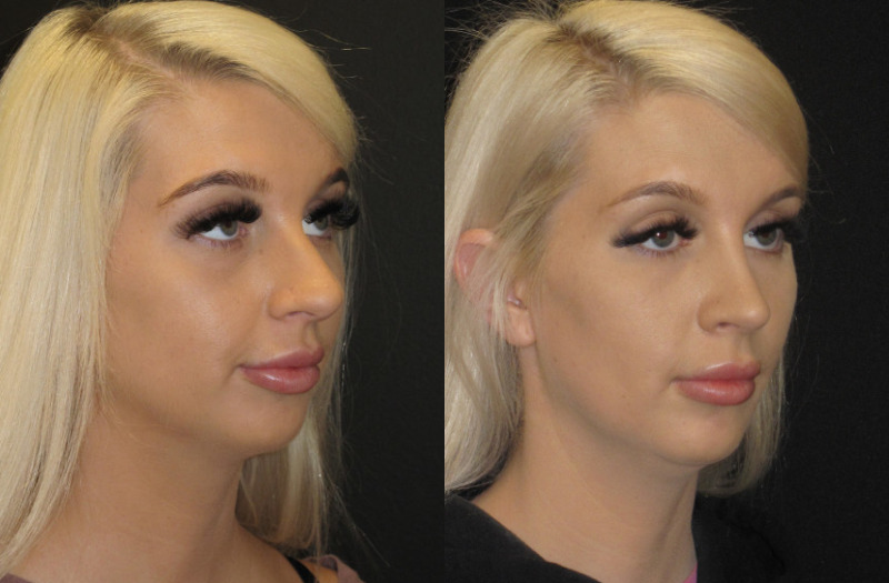 Patient 59 Combined Image