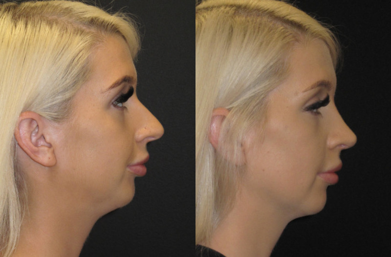 Patient 59 Combined Image