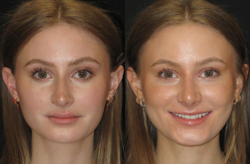 Patient 67 Combined Image