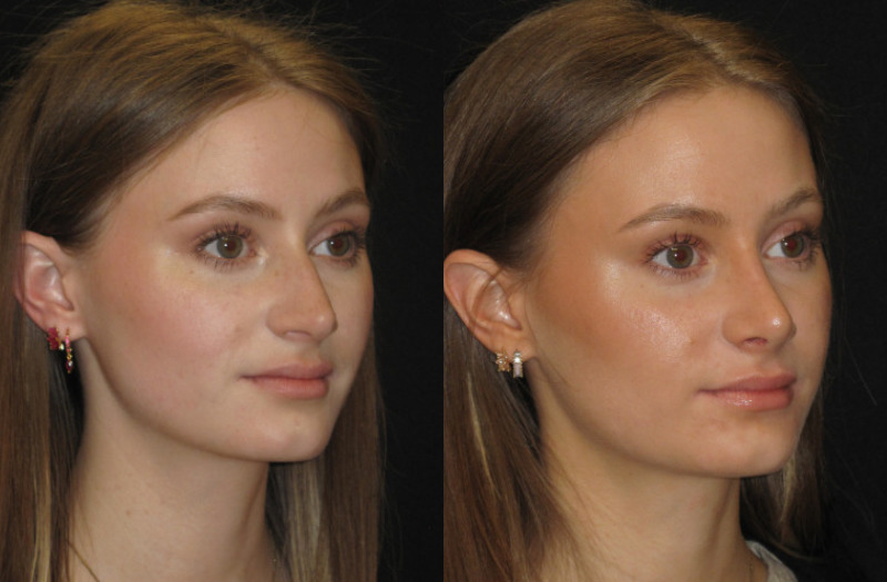 Patient 67 Combined Image