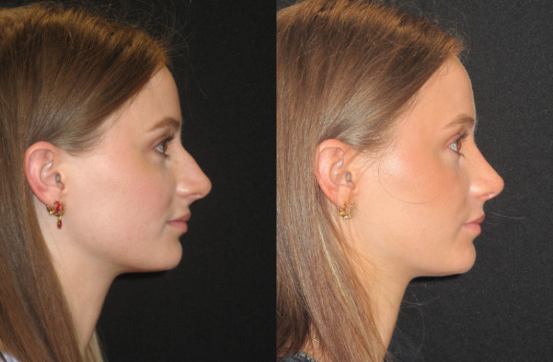 Patient 67 Combined Image