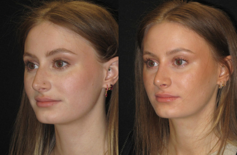 Patient 67 Combined Image