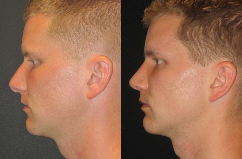 Patient 68 Combined Image