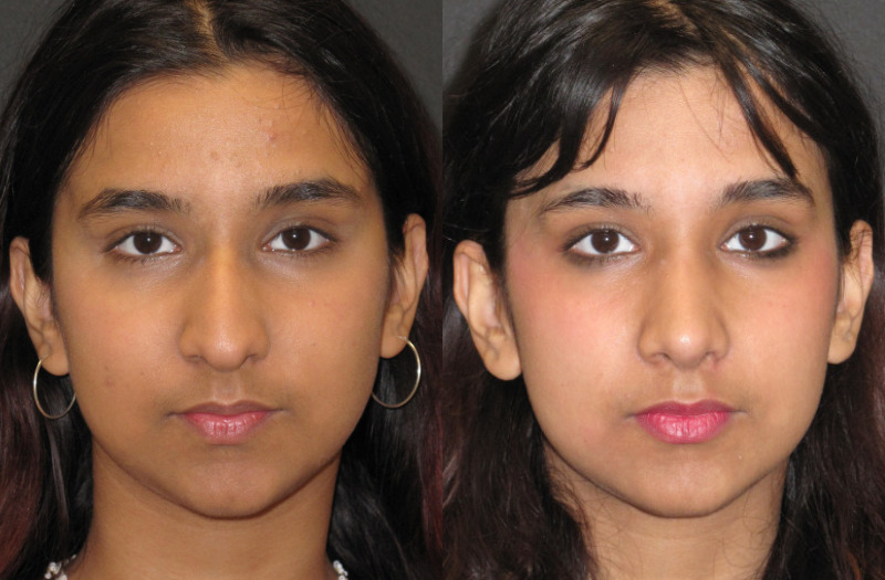 Patient 65 Combined Image