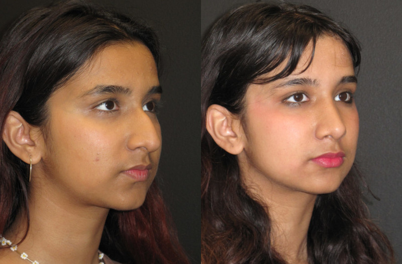 Patient 65 Combined Image