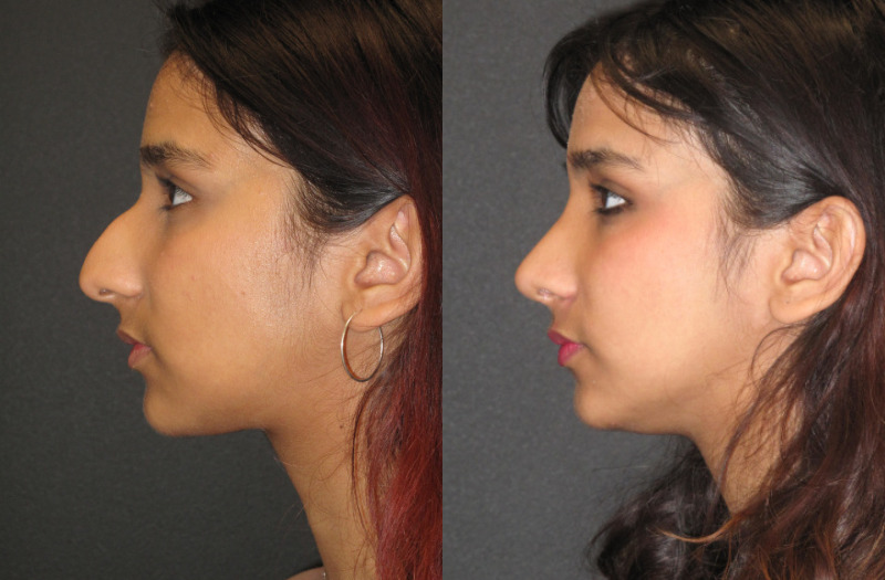 Patient 65 Combined Image