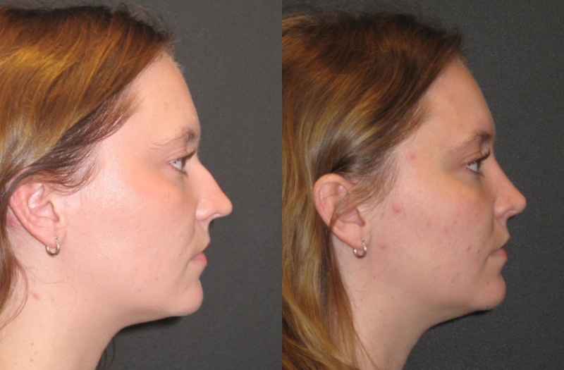 Patient 62 Combined Image