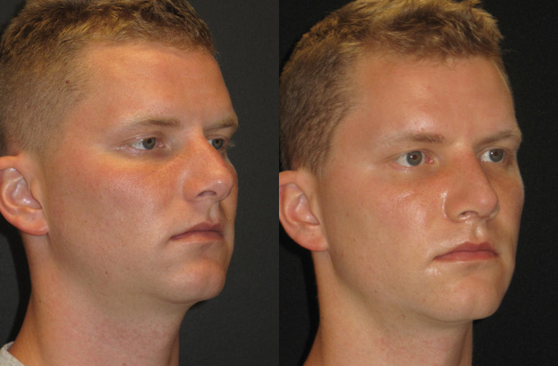 Patient 68 Combined Image