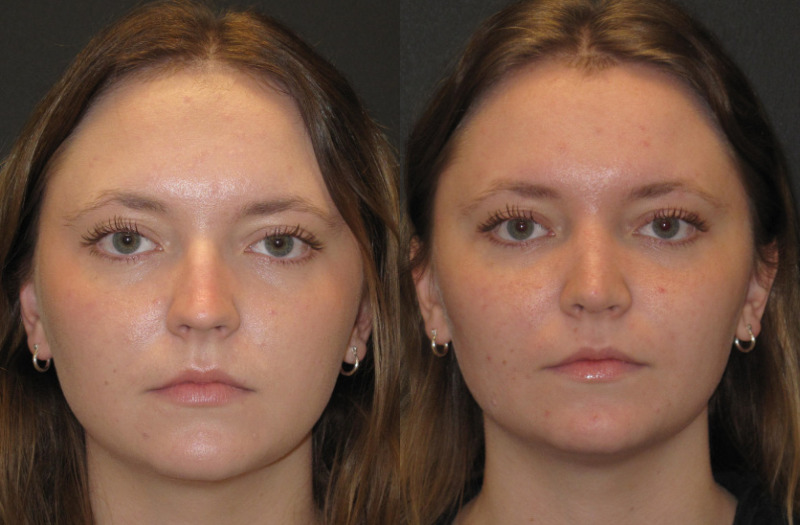 Patient 62 Combined Image