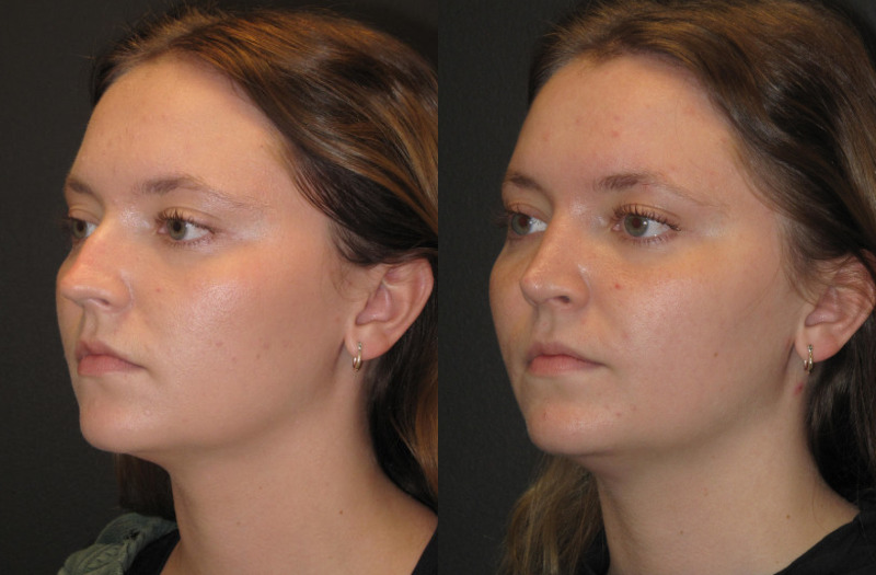 Patient 62 Combined Image