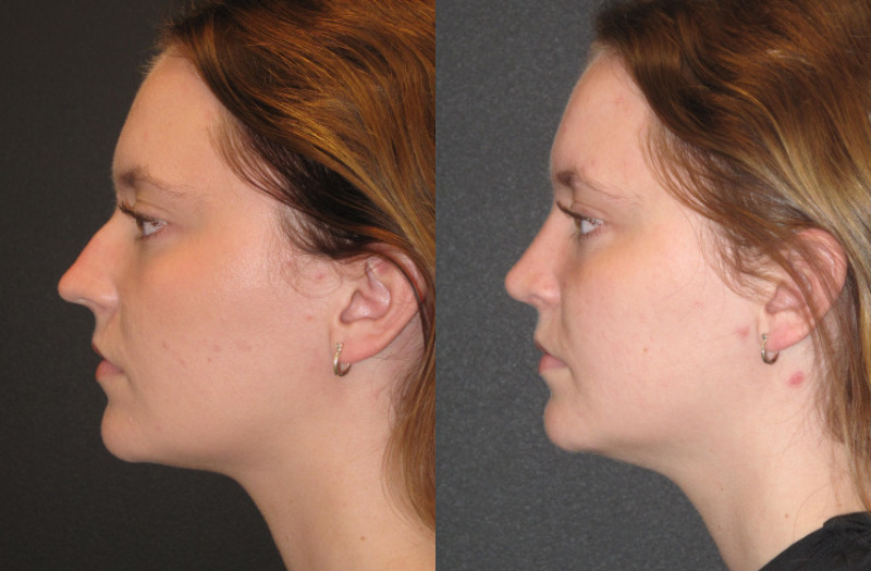 Patient 62 Combined Image