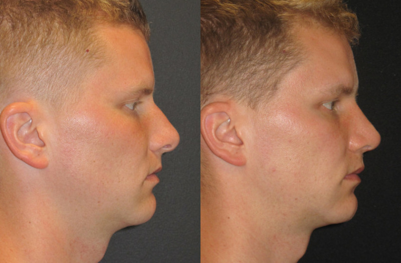 Patient 68 Combined Image
