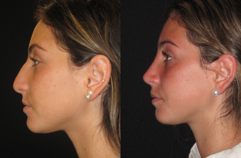 Patient 78 Combined Image