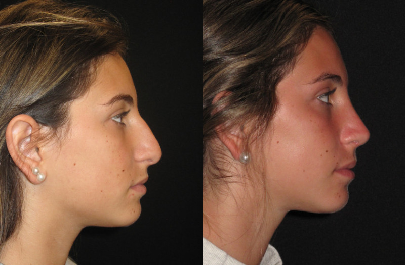 Patient 78 Combined Image