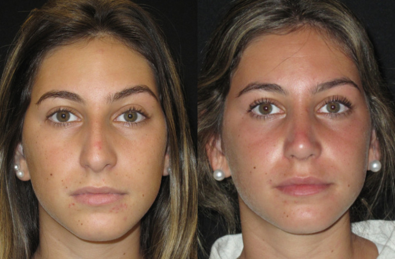 Patient 78 Combined Image