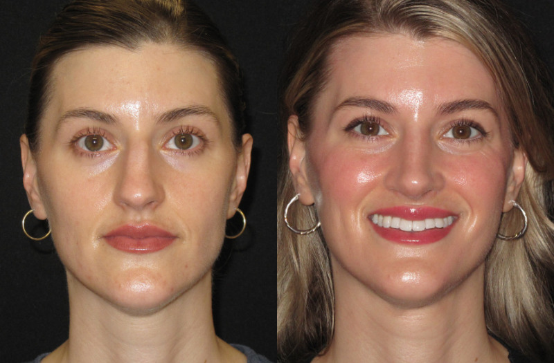 Patient 79 Combined Image