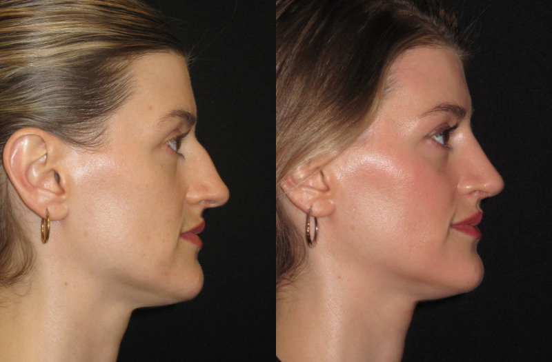 Patient 79 Combined Image