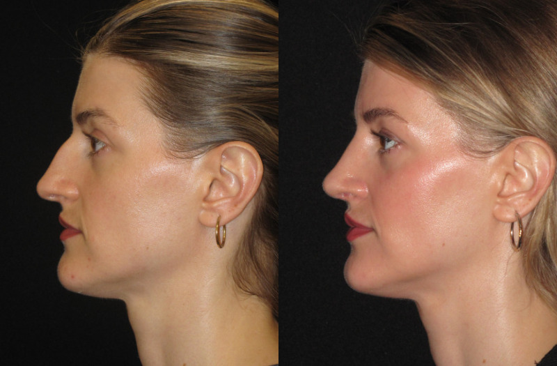 Patient 79 Combined Image