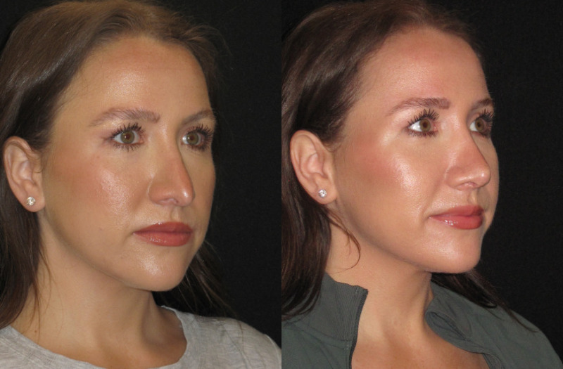 Patient 76 Combined Image