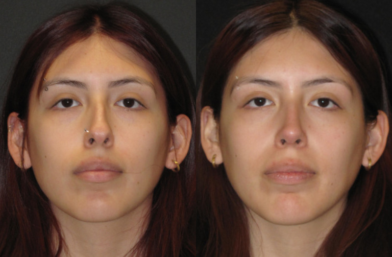 Patient 63 Combined Image