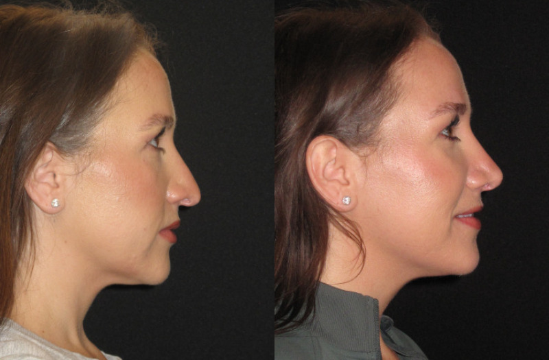 Patient 76 Combined Image