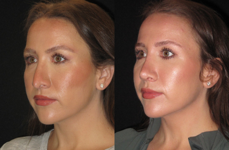 Patient 76 Combined Image