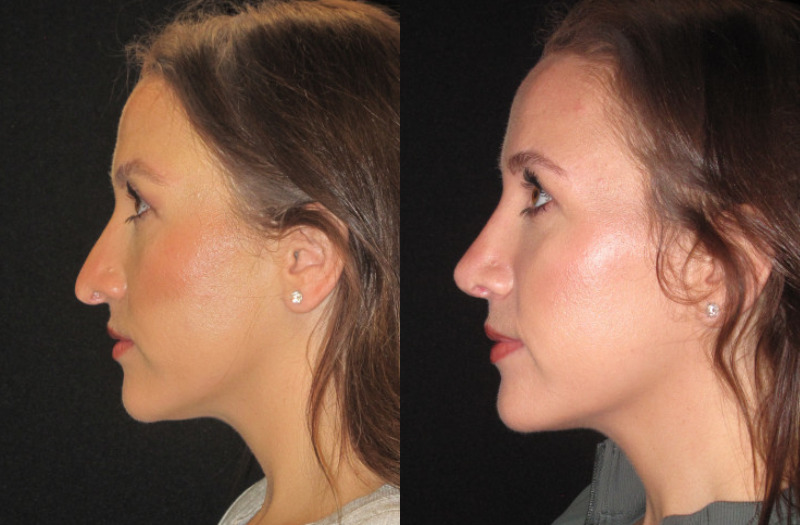 Patient 76 Combined Image