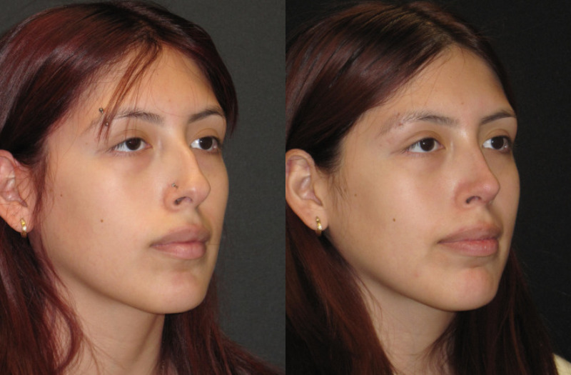 Patient 63 Combined Image