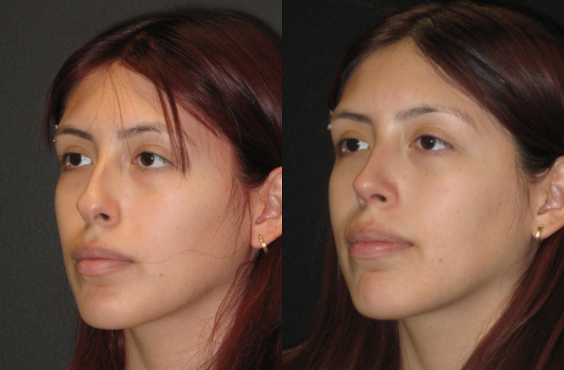 Patient 63 Combined Image