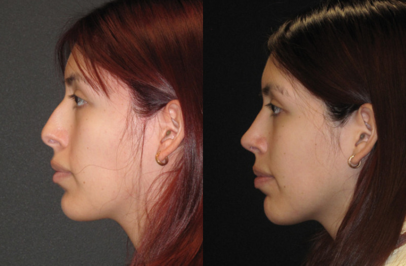 Patient 63 Combined Image