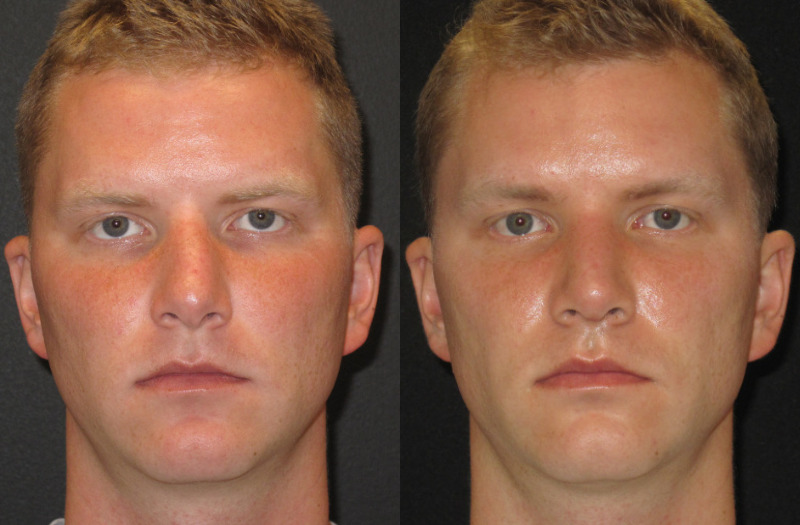 Patient 68 Combined Image