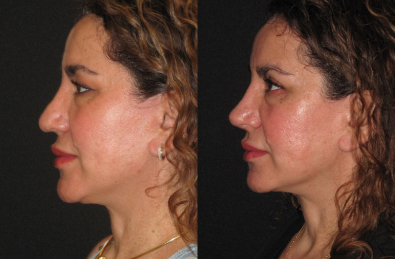 Patient 77 Combined Image