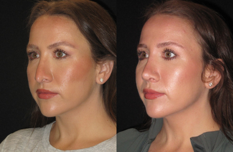 Patient 76 Combined Image