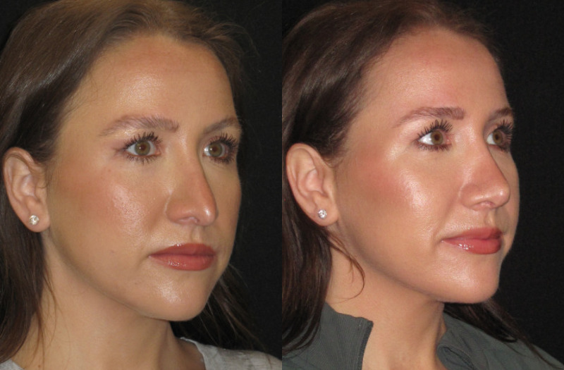 Patient 76 Combined Image