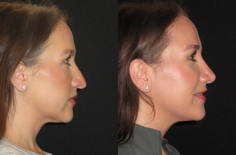 Patient 76 Combined Image