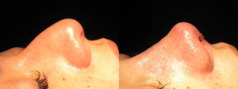 Patient 65 Combined Image