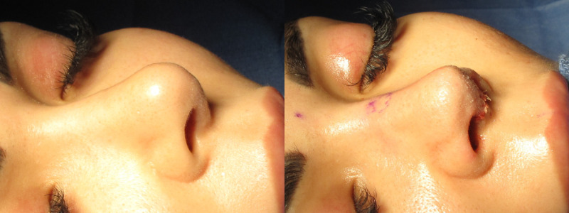 Patient 63 Combined Image