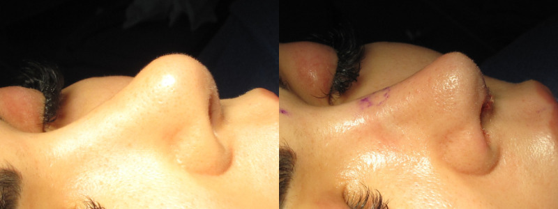 Patient 63 Combined Image