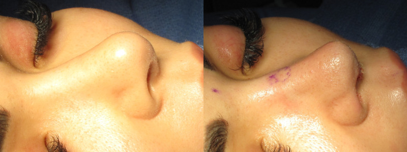 Patient 63 Combined Image