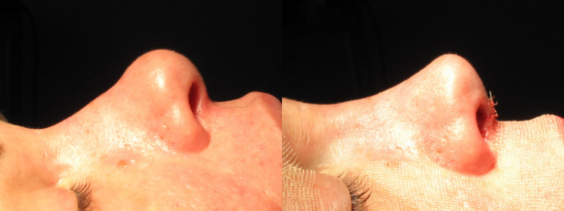 Patient 64 Combined Image