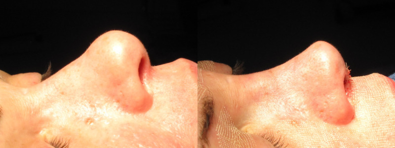 Patient 64 Combined Image