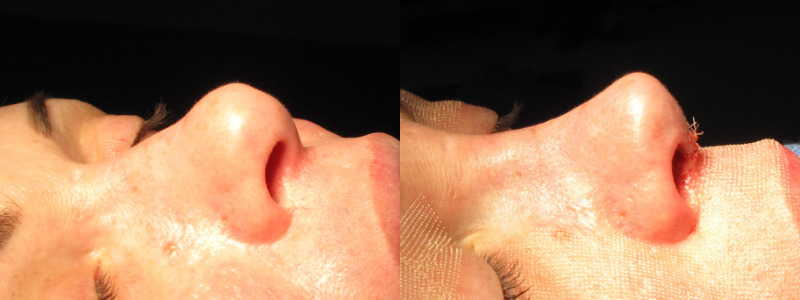 Patient 64 Combined Image