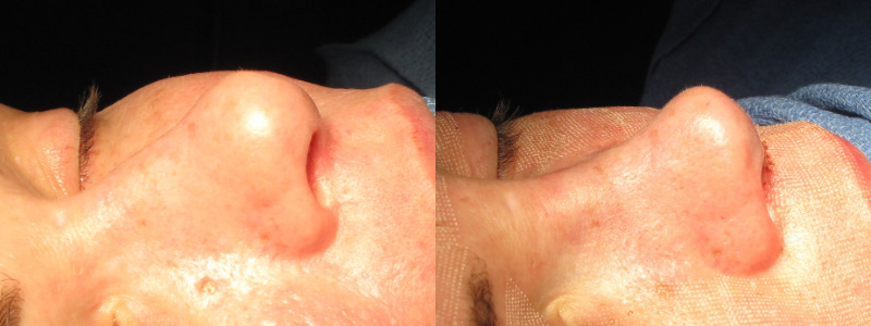 Patient 64 Combined Image