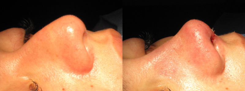 Patient 65 Combined Image