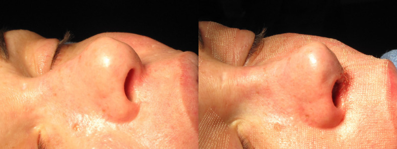 Patient 64 Combined Image