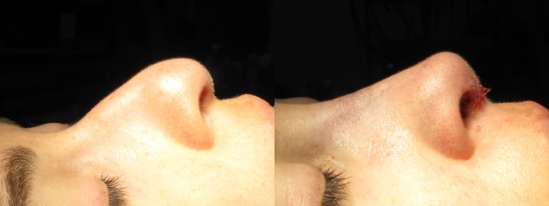 Patient 60 Combined Image